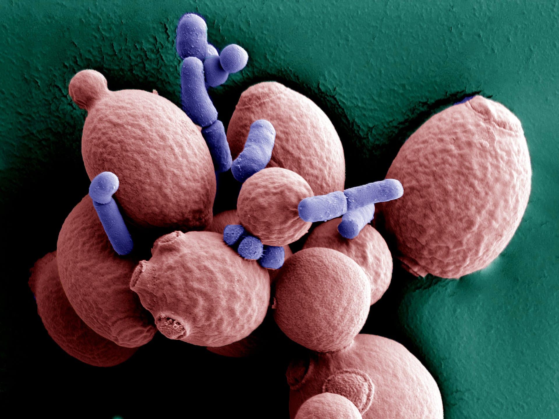 Bacteria and yeasts in a sourdough starter.